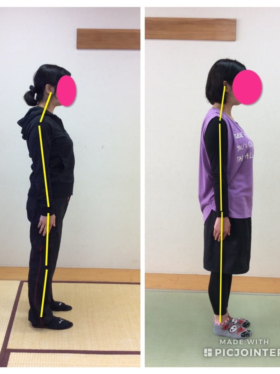 小平市の姿勢改善