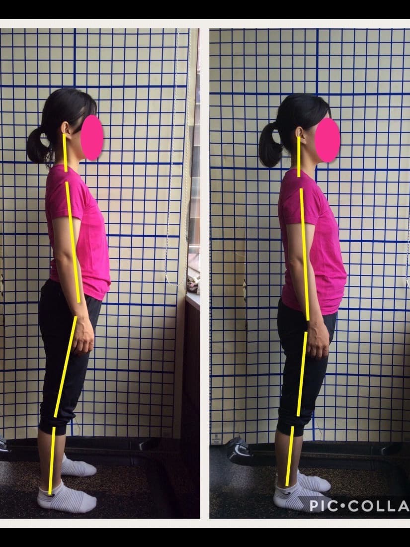 小平市の姿勢改善