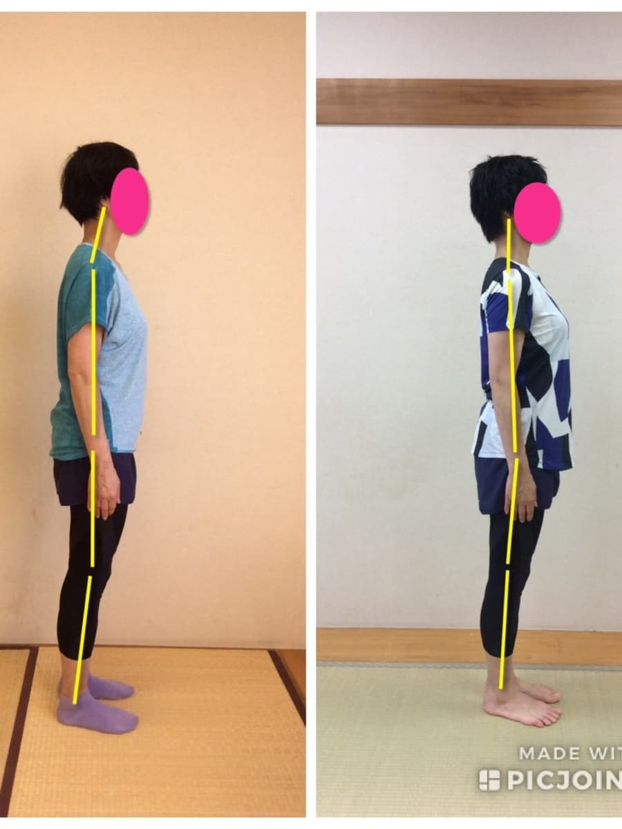 小平市の姿勢改善